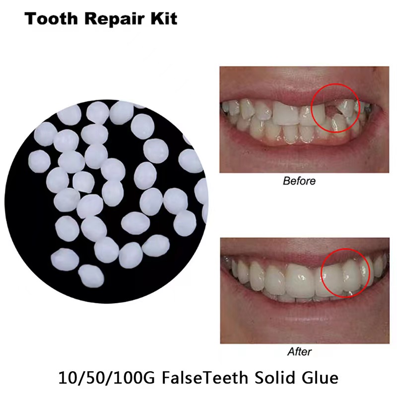 Teeth Whitening Mask - 10 กรัม/ถุงชุดซ่อมฟัน-ลูกปัดความร้อนสําหรับบรรจุ Fix ที่หายไปและหักฟันหรือกาวฟันปลอมฟันปลอม Gutta ต่อ