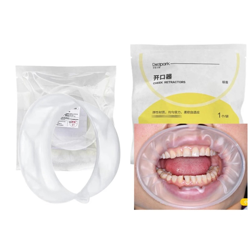 Teeth Whitening Clinic - 20 ชิ้น Dentpark อุปกรณ์ถ่างปากทรงโอแบบใช้แล้วทิ้ง ที่เปิดปากแบบยืดหยุ่น สำหรับคลินิกทันตกรรม