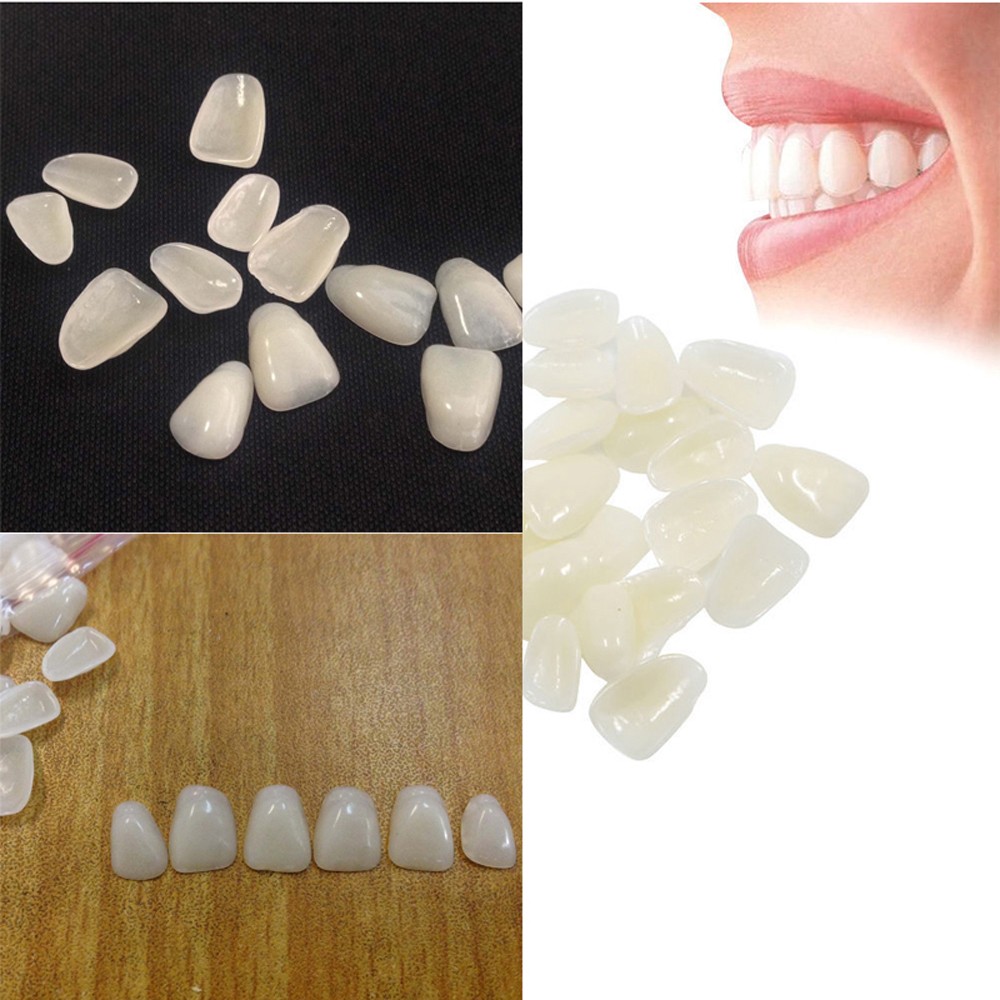 Teeth Whitening Mask - วีเนียร์ฟอกสีฟันแบบบางพิเศษ 70 ชิ้น/แพ็คเกจ ฟิล์มฟันเรซิ่นสำหรับฟันหน้าบน
