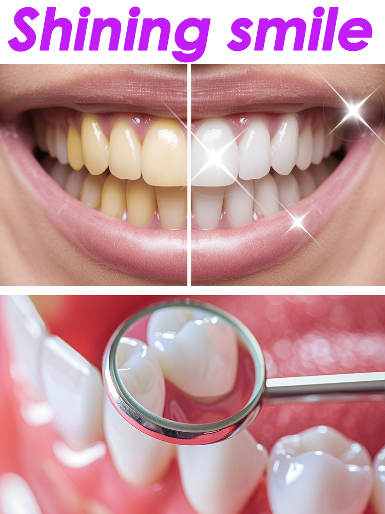 GlorySmile ฟันไวท์เทนนิ่ง Frui - Teeth Whitening Xylitol บทวิจารณ์และราคา
