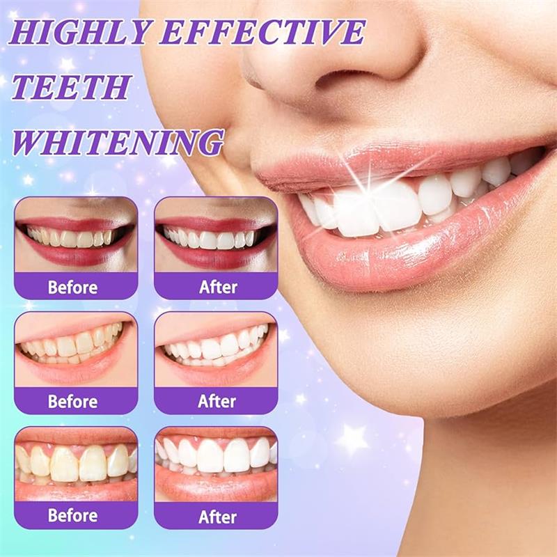 ยาสีฟันมูสฟอกสีฟัน 9D สีม่วง ข - Teeth Whitening Natural บทวิจารณ์และราคา