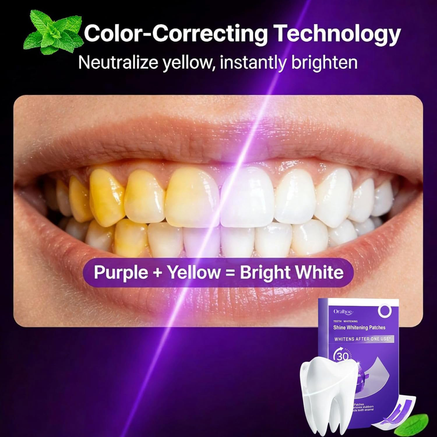 ชุดคอมโบฟอกสีฟันสีม่วง – แผ่นข - Teeth Whitening Home Kit บทวิจารณ์และราคา
