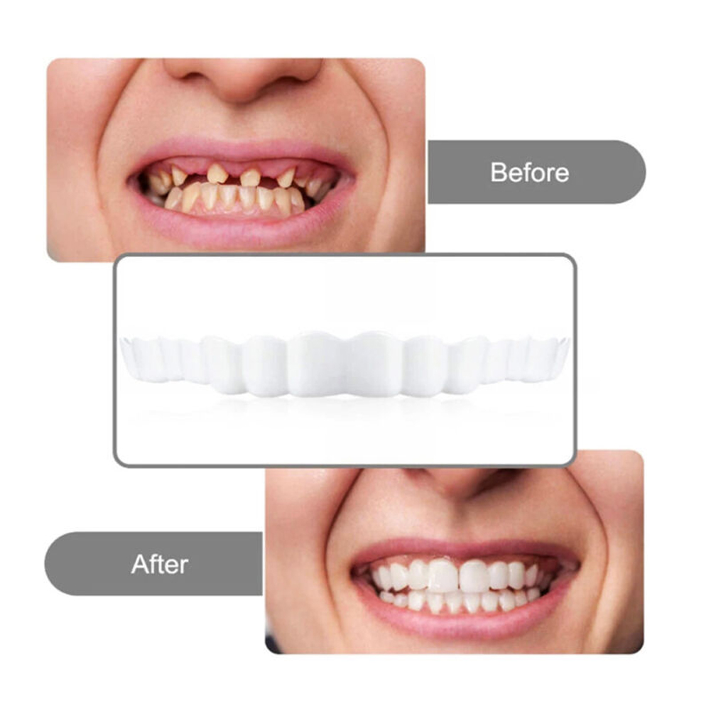 4-6 คู่ Upper & Lower Jaw ฟันป - Teeth Whitening Mask บทวิจารณ์และราคา