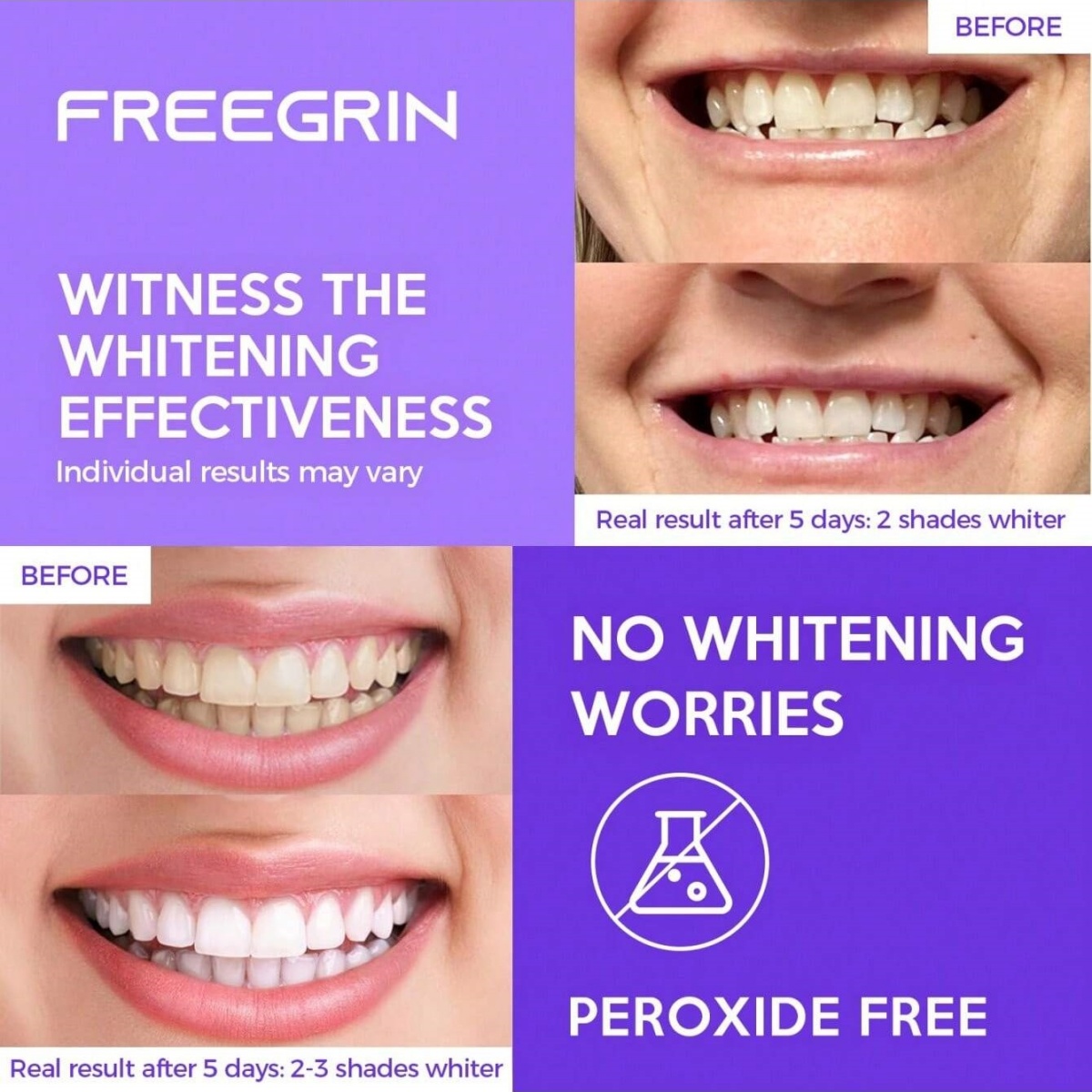 ดีลักซ์สติกเกอร์ฟอกสีฟัน 7/14/ - Teeth Whitening Price บทวิจารณ์และราคา