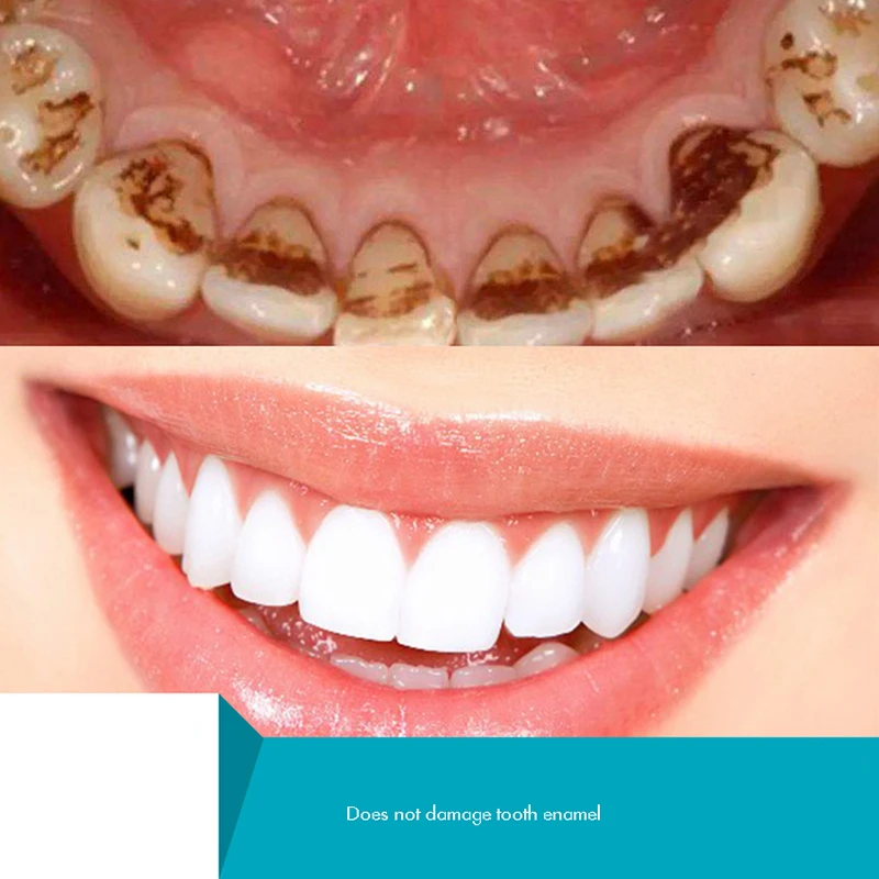 ฟันผง,ผงฟอกสีฟันธรรมชาติ,Tooth - Teeth Whitening Xylitol บทวิจารณ์และราคา