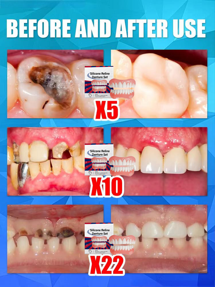ฟันปลอมซิลิโคน ฟันปลอมบนล่าง ว - Teeth Whitening Mask บทวิจารณ์และราคา