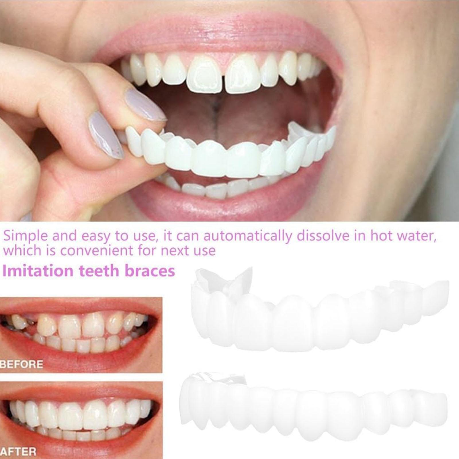วีเนียร์ฟันปลอมชั่วคราวสำหรับผ - Teeth Whitening Mask บทวิจารณ์และราคา