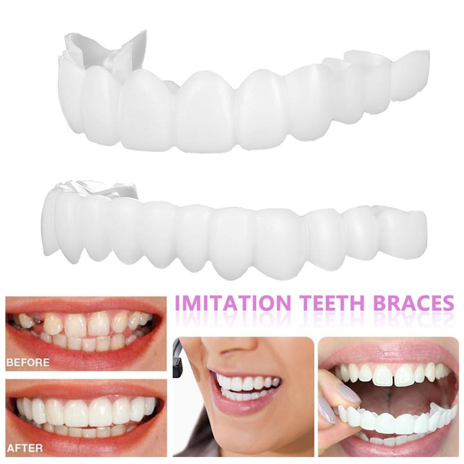วีเนียร์ฟันปลอมชั่วคราวสำหรับผ - Teeth Whitening Mask บทวิจารณ์และราคา