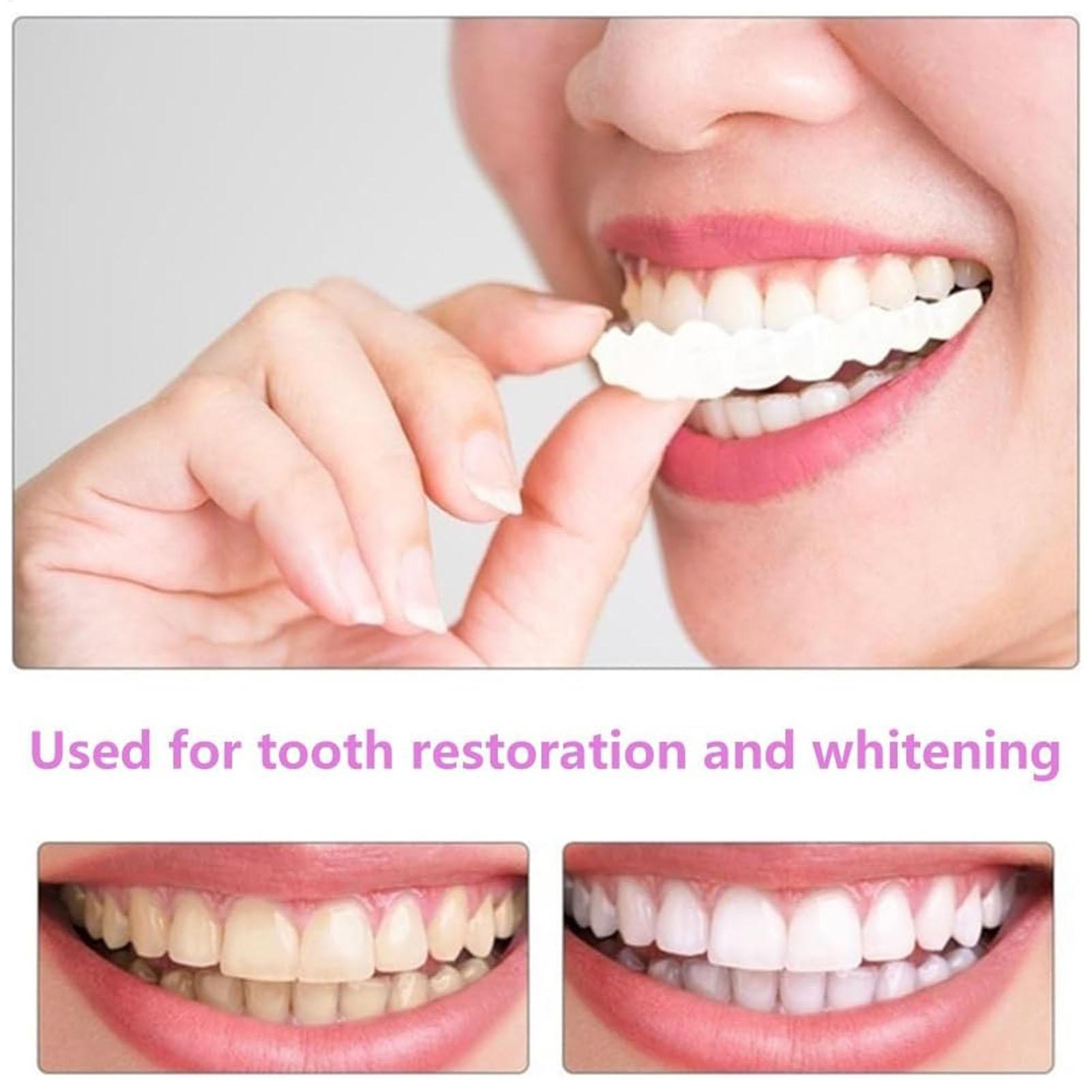 วีเนียร์ฟันปลอมชั่วคราวสำหรับผ - Teeth Whitening Mask บทวิจารณ์และราคา