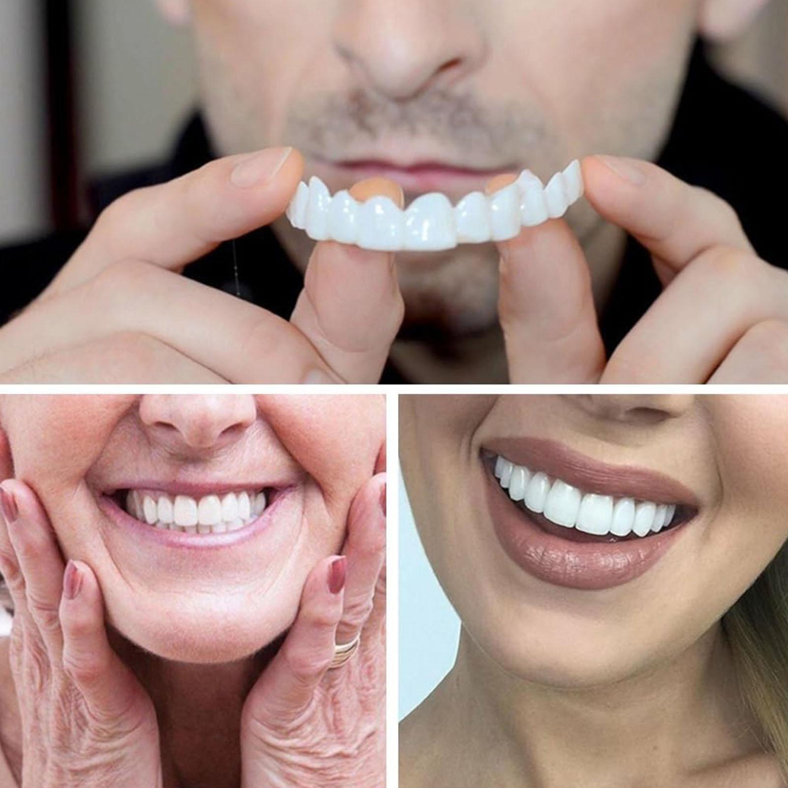 วีเนียร์ฟันปลอมชั่วคราวสำหรับผ - Teeth Whitening Mask บทวิจารณ์และราคา