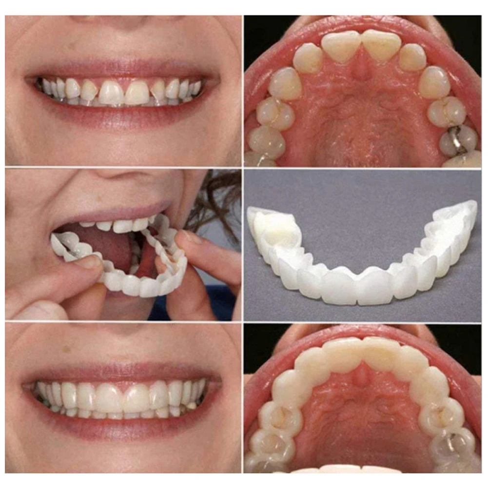 ฟันปลอม2คู่ Comfort ดูแลฟันฟัน - Teeth Whitening Mask บทวิจารณ์และราคา
